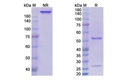 Invitrogen Volociximab Chimeric Recombinant Human Monoclonal Antibody 100