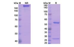 Invitrogen Exbivirumab Recombinant Human Monoclonal Antibody 100 &mu;g;