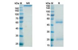 Invitrogen Belimumab Recombinant Human Monoclonal Antibody 100 &mu;g; Unconjugated:Antibodies,