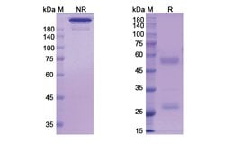Invitrogen Pritumumab Recombinant Human Monoclonal Antibody 100 &mu;g;