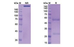 Invitrogen Aselizumab Humanized Recombinant Human Monoclonal Antibody 100