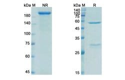 Invitrogen Ecromeximab Chimeric Recombinant Human Monoclonal Antibody 100 &mu;g | Buy Online | Invitrogen&trade; | Fisher Scientific