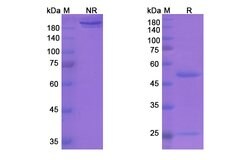 Invitrogen Vapaliximab Chimeric Recombinant Human Monoclonal Antibody 100 &mu;g | Buy Online | Invitrogen&trade; | Fisher Scientific