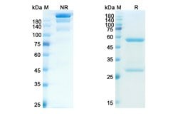 Invitrogen Erlizumab Humanized Recombinant Human Monoclonal Antibody 100 &mu;g | Buy Online | Invitrogen&trade; | Fisher Scientific