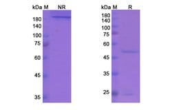 Invitrogen Cixutumumab Recombinant Human Monoclonal Antibody 100 &mu;g;
