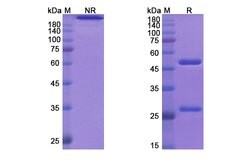 Invitrogen Necitumumab Recombinant Human Monoclonal Antibody 100 &mu;g;
