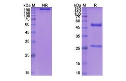 Invitrogen Siltuximab Chimeric Recombinant Human Monoclonal Antibody 100
