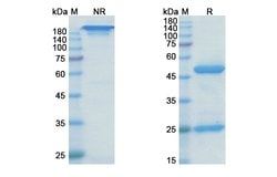 Invitrogen Rilotumumab Recombinant Human Monoclonal Antibody 100 &mu;g;