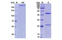 Invitrogen Minretumomab Recombinant Mouse Monoclonal Antibody 100 &mu;g;