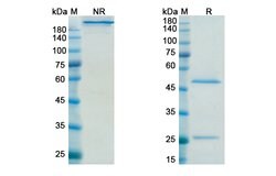 Invitrogen Sifalimumab Recombinant Human Monoclonal Antibody 100 &mu;g | Buy Online | Invitrogen&trade; | Fisher Scientific