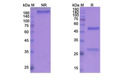 Invitrogen Fezakinumab Recombinant Human Monoclonal Antibody 100 &mu;g | Buy Online | Invitrogen&trade; | Fisher Scientific