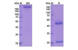 Invitrogen Secukinumab Recombinant Human Monoclonal Antibody 100 &mu;g;