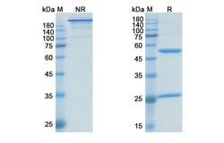 Invitrogen Dalotuzumab Humanized Recombinant Human Monoclonal Antibody