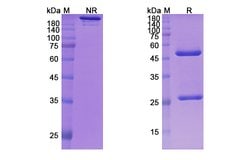 Invitrogen Mavrilimumab Recombinant Human Monoclonal Antibody 100 &mu;g | Buy Online | Invitrogen&trade; | Fisher Scientific