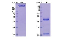 Invitrogen Teprotumumab Recombinant Human Monoclonal Antibody 100 &mu;g | Buy Online | Invitrogen&trade; | Fisher Scientific