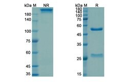 Invitrogen Drozitumab Recombinant Human Monoclonal Antibody 100 &mu;g | Buy Online | Invitrogen&trade; | Fisher Scientific