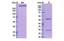 Invitrogen Ensituximab Chimeric Recombinant Human Monoclonal Antibody 100 &mu;g | Buy Online | Invitrogen&trade; | Fisher Scientific