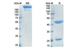 Invitrogen Itolizumab Humanized Recombinant Human Monoclonal Antibody 100