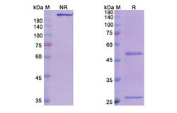 Invitrogen Olokizumab Humanized Recombinant Human Monoclonal Antibody 100 &mu;g | Buy Online | Invitrogen&trade; | Fisher Scientific