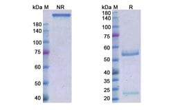 Invitrogen Roledumab Recombinant Human Monoclonal Antibody 100 &mu;g; Unconjugated:Antibodies,