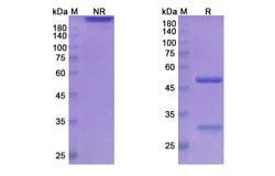 Invitrogen Atinumab Recombinant Human Monoclonal Antibody 100 &mu;g; Unconjugated:Antibodies,