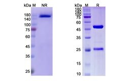 Invitrogen Enokizumab Humanized Recombinant Human Monoclonal Antibody 100