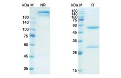 Invitrogen Namilumab Recombinant Human Monoclonal Antibody 100 &mu;g; Unconjugated:Antibodies,