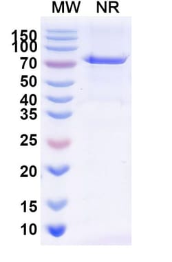 Invitrogen Radretumab Recombinant Human Monoclonal Antibody 100 &mu;g | Buy Online | Invitrogen&trade; | Fisher Scientific
