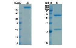 Invitrogen Vesencumab Recombinant Human Monoclonal Antibody 100 &mu;g | Buy Online | Invitrogen&trade; | Fisher Scientific