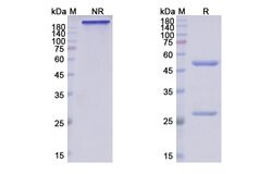 Invitrogen Crenezumab Humanized Recombinant Human Monoclonal Antibody 100