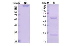 Invitrogen Narnatumab Recombinant Human Monoclonal Antibody 100 &mu;g;