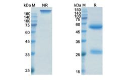 Invitrogen Sirukumab Recombinant Human Monoclonal Antibody 100 &mu;g; Unconjugated:Antibodies,