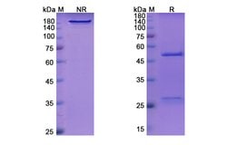 Invitrogen Indatuximab Chimeric Recombinant Human Monoclonal Antibody 100