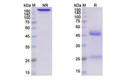 Sarilumab Recombinant Human Monoclonal Antibody:Antibodies, Recombinant