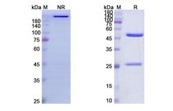 Invitrogen Flanvotumab Recombinant Human Monoclonal Antibody 100 &mu;g;