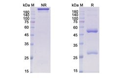 Invitrogen Patritumab Recombinant Human Monoclonal Antibody 100 &mu;g;