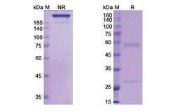 Invitrogen Actoxumab Recombinant Human Monoclonal Antibody 100 &mu;g | Buy Online | Invitrogen&trade; | Fisher Scientific