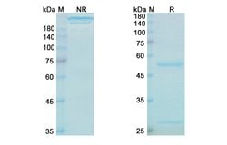 Invitrogen Bezlotoxumab Recombinant Human Monoclonal Antibody 100 &mu;g;