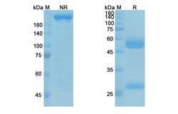 Invitrogen Alirocumab Recombinant Human Monoclonal Antibody 100 &mu;g | Buy Online | Invitrogen&trade; | Fisher Scientific
