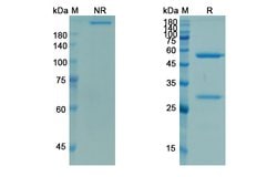 Invitrogen Demcizumab Humanized Recombinant Human Monoclonal Antibody 100
