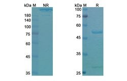 Duligotuzumab Humanized Recombinant Human Monoclonal Antibody 100 &mu;g | Buy Online | Thermo Scientific | Fisher Scientific