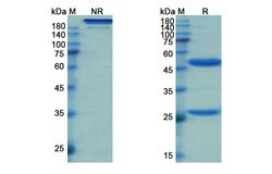 Invitrogen Fasinumab Recombinant Human Monoclonal Antibody 100 &mu;g; Unconjugated:Antibodies,