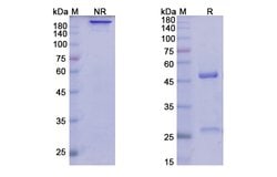 Invitrogen Lirilumab Recombinant Human Monoclonal Antibody 100 &mu;g; Unconjugated:Antibodies,