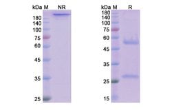 Invitrogen Nivolumab Recombinant Human Monoclonal Antibody 100 &mu;g | Buy Online | Invitrogen&trade; | Fisher Scientific