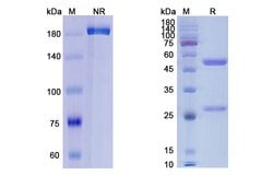 Invitrogen Orticumab Recombinant Human Monoclonal Antibody 100 &mu;g | Buy Online | Invitrogen&trade; | Fisher Scientific