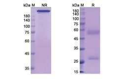 Invitrogen Perakizumab Humanized Recombinant Human Monoclonal Antibody