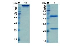 Invitrogen Simtuzumab Humanized Recombinant Human Monoclonal Antibody 100