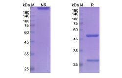 Invitrogen Concizumab Humanized Recombinant Human Monoclonal Antibody 100 &mu;g | Buy Online | Invitrogen&trade; | Fisher Scientific