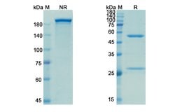 Invitrogen Evolocumab Recombinant Human Monoclonal Antibody 100 &mu;g;