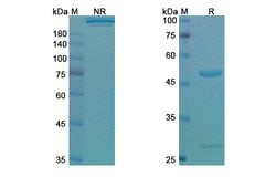 Dupilumab Recombinant Human Monoclonal Antibody, Invitrogen 100 &mu;g;